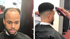 The hairstyles make a man's hair look thicker. Man Weaves A Game Changer For Balding Men Cash For 2 5 Billion Black Haircare Industry Npr