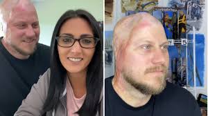 Homem escapa da morte após ser atingido por descarga elétrica de mais de  4.000 Volts