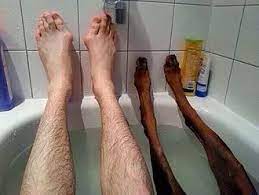 Es bastante sencillo de preparar y totalmente natural y efectivo contra los hongos en los pies. Si Te Parecen Asquerosos Los Pies Estas 22 Imagenes Te Haran Vomitar Increible