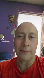 Ojos 👀 Rojos 🧧