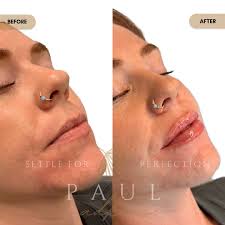 Paul Adkins BSN, RN, FNP-S 💉