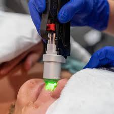 Laser hair removal gets you closer to your curves with smooth, hairless skin that at dolce aesthetics ny every laser specialist is a licensed esthetician and certified laser technician with extensive experience in both lasers and skin care. Motus Laser Hair Removal Laser Hair Removal Hair Removal Master Esthetician