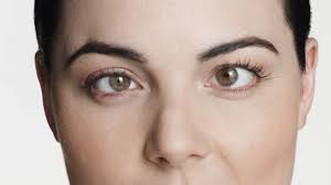 Schielen Strabismus Symptome Onmeda De