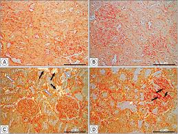 Health Risks Associated with Long-Term Finasteride and Dutasteride Use:  It's Time to Sound the Alarm