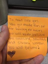 Alopecia : The Story Of My Life