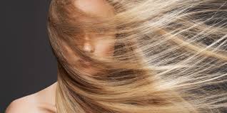 как избавиться от перхоти и выпадения волос в домашних условиях Kak Izbavitsya Ot Perhoti V Etoj State My Sobrali 10 Raznyh Receptov Effektivnyh Sredst Zdorovye Dlinnye Volosy Ukladka Dlinnyh Volos Lechenie Vypadeniya Volos