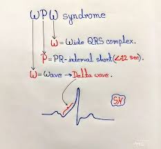 Pin By Kasia On Cardiology Paramedic School Medical Mnemonics Emergency Nursing