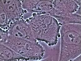 Check spelling or type a new query. Mitosis In An Animal Cell Stock Video Clip K003 2887 Science Photo Library