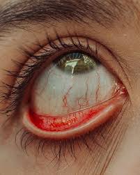 Matias Alonso Revelli Matialonsor Fotos E Videos Do Instagram Aesthetic Eyes Artwork Eye Art Aesthetic Eyes