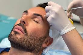 Jan Thomas tok hårtransplantasjon hos Medicura