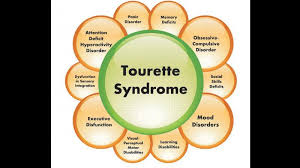 Tourette syndrome is a condition that affects a person's central nervous system and causes tics (movements or sounds that a person can't control and that are repeated over and over). Afer Hichki Tourette Syndrome Gains Attention