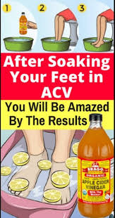 Soak Your Feet In Apple Cider Vinegar The Results Will Amaze You Cider Vinegar Benefits Apple Cider Vinegar Detox Foot Detox Soak