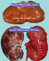 What does buah pinggang mean in malay? Cara Buah Pinggang Berfungsi Dalam Sistem Tubuh Kita Ohcantik Com