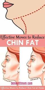 Pin On Health