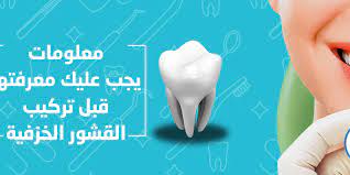 صرير الأسنان أثناء النوم الأسباب والمضاعفات وطرق العلاج المستشفى الأردني الفنلندي الحديث