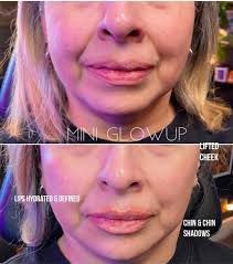 Irene Ware- Nurse Injector (@injector_irene) • Instagram photos and videos