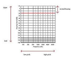 How to read and audiogram? the various degrees of hearing loss should you get a copy of your audiogram? additionally, the world health organization (who) estimates that 1.1 billion teenagers and young adults around the world are at risk for hearing loss from unsafe use of audio devices or. Audiogram Wikipedia