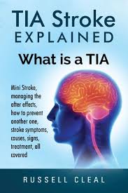 Tia can mean any of the following: Tia Stroke Explained What Is A Tia Mini Stroke Managing The After Effects How To Prevent Another One Stroke Symptoms Causes Signs Treatment All Covered Cleal Russell 9780995561052 Amazon Com Books