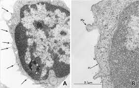 We did not find results for: A Tem Of A T Cell Treated With Dreg 56 Anti L Selectin Plus Download Scientific Diagram