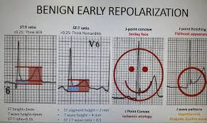Image result for Early Repolarization
