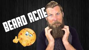 Acne typically appears on your face, forehead, chest, upper back and shoulders because these areas of skin have the most oil (sebaceous) glands. Beard Acne Cause And Effect Of Dry Skin Youtube
