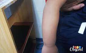 Ibu jari memiliki dua tulang dan jari yang lain memiliki tiga tulang. Tangan Atau Kaki Patah Apa Akibat Jika Tidak Dibawa Ke Hospital Free Malaysia Today Fmt