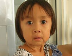 Trẻ bị lão hóa có thể do đột biến gene