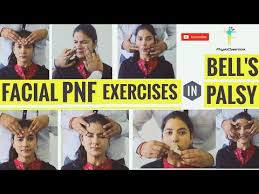 Some cases will result in incomplete recovery or leave residuals. Facial Pnf Exercises In Bell S Palsy Youtube