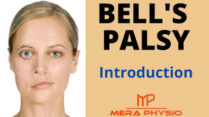 One hypothesis is that many bell's palsy cases result from viruses such as herpes simplex and herpes zoster. Bell S Palsy Introduction Of Bell S Palsy In Hindi Mera Physio
