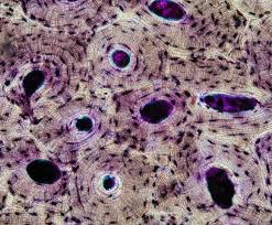 Compact bone cross section courtesy: Bone Tissue And Cells Under The Microscope