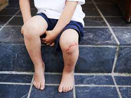You can handle everyday scrapes and scratches on your own, but for more serious cuts, you might need stitches. When To Get Stitches How To Tell If Your Cut Needs Sewing Up