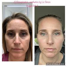 Elizabeth Simon Hogan,MMS,PA-C (@skinspiration_aesthetics) • Instagram  photos and videos