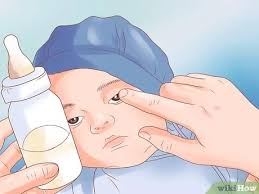 Einen Verstopften Tranenkanal Losen 12 Schritte Mit Bildern Wikihow