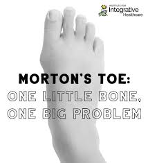 Why Is Your Second Toe Longer Than Your First Massage Professionals Update Morton S Toe Second Toe Second Toe Longer