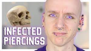 3 Ways To Treat An Infected Nose Piercing Wikihow