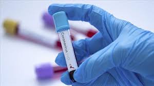 A diagnostic test can show if you have an active coronavirus infection. Covid 19 Le Ministre Soudanais De La Sante Teste Positif