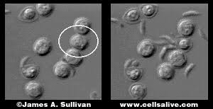 Fluid loss may be severe in clinical cases. Water Research Center Cryptosporidium Parvum Drinking Water Protozoan