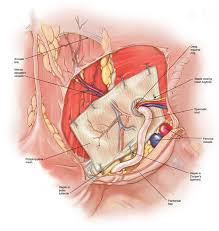 Surgery Laparoscopic Hernia Repair May Be Considered In Nearly All Patients Diagnosed With An Abdom Perioperative Nursing Abdominal Surgery Human Body Anatomy