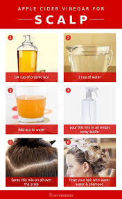 Tips Tricks And Techniques For Hair You Ll Love You Can Find Out More Details At The Link Of The Image Hairs Dry Itchy Scalp Itchy Dry Psoriasis Remedies