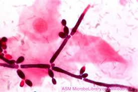 Området utenfor skjeden kan også føles sårt og klø. Underlivet Det Er Ikke Sopp Alt Som Klor