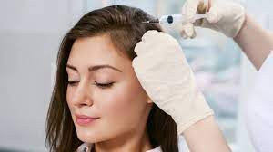 مزوتراپی موی سر؛ راهکار موثر کم پشتی و ریزش مو