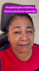 Cirurgia No Olho Para Tirar O Branco Da Cegueira