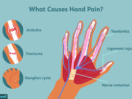 Diagram depicting the bones, ligaments and muscles throughout the hand and fingers. Hand Pain Causes And Treatments