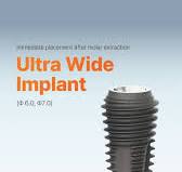 The Ultra Wide Implant is designed to be placed immediately after the  extraction of a molar or following the removal of a failed implant., 1.  Immediate placement in an extraction socket in the ...