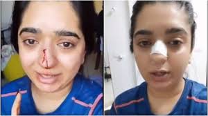 3,383 likes · 1,474 talking about this. Video Of Bengaluru Woman S Scuffle With Zomato Delivery Boy Goes Viral Twitter Demands Full Version Trending News India Tv
