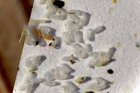 Image result for bed bugs eggs