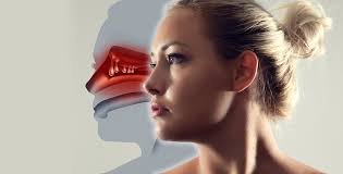Nasal polyps are painless soft growths inside your nose. Nasal Polyps Allergy Asthma Network
