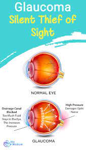 Pin On Eye Treatment