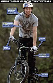 Agony Of Bike Daredevil Catalogue Of Injuries Keeps Internet Stunt Sensation From Cycling For Two Years Bike Trial Bike Stunts