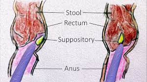 1 suppository, or as directed by a doctor. Rectal Suppositories How To Use Them Youtube